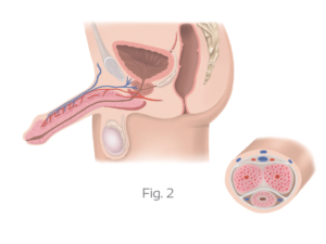 ereksiyon nasil olusur